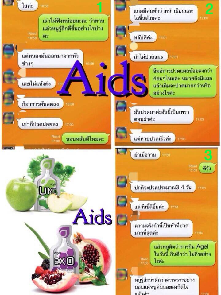 HIV vs UMI2