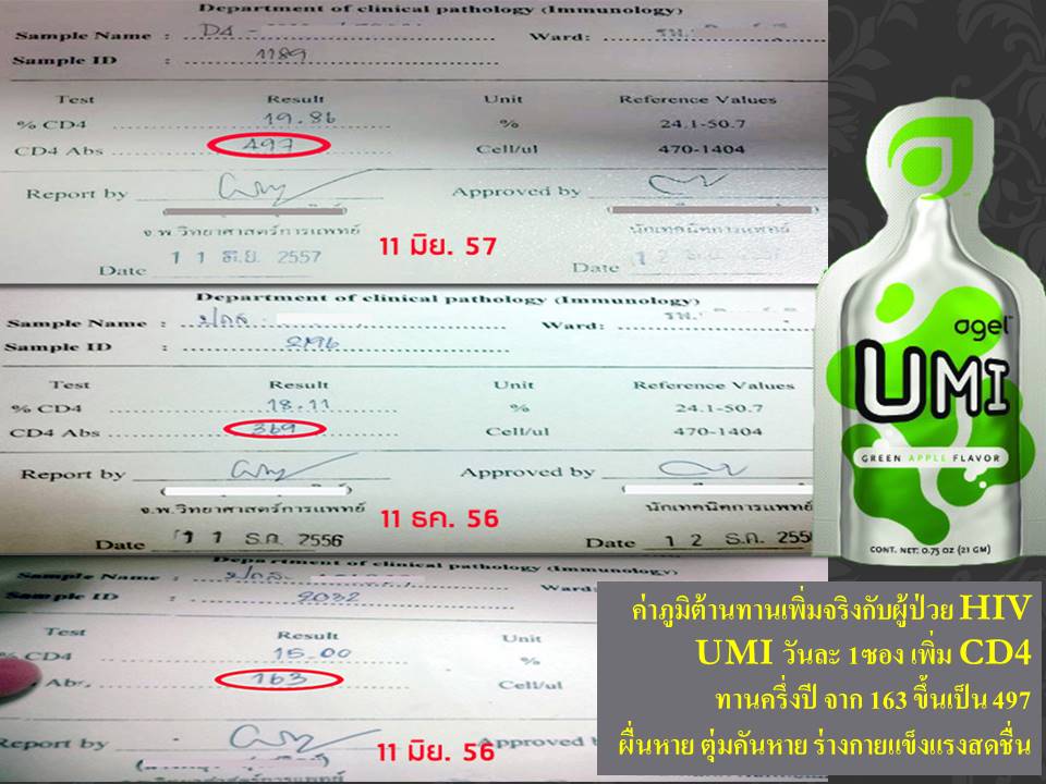 UMI HIV CD4 01